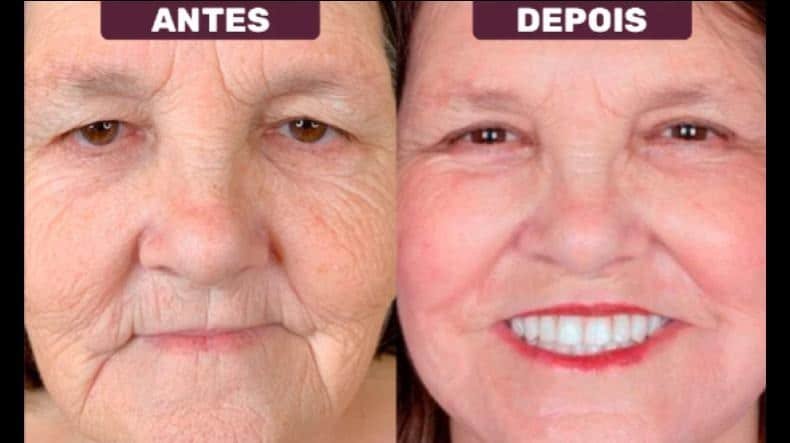 Resvera Queen Funciona? Resvera Queen Vale a Pena?